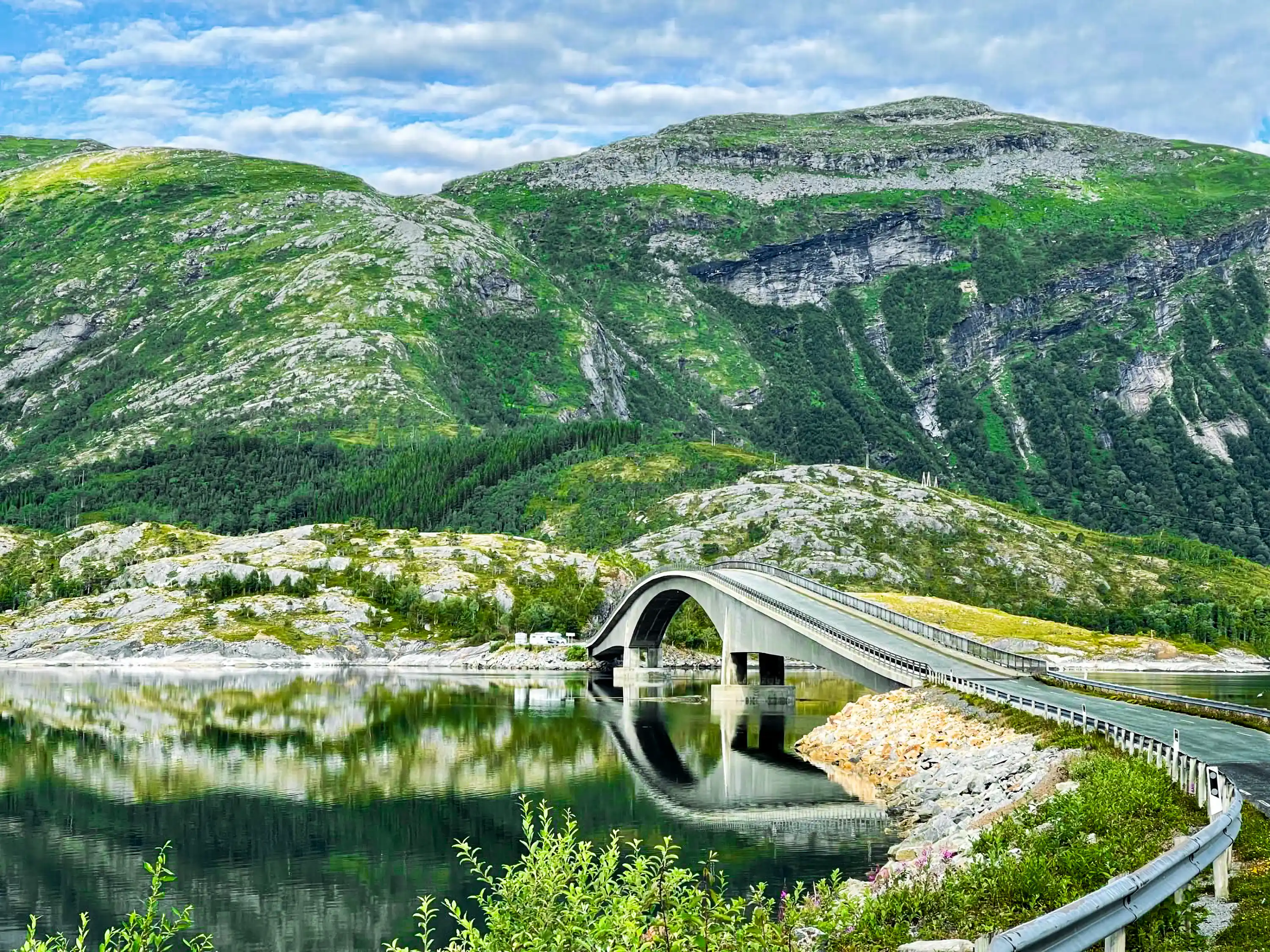 dental implants anxiety